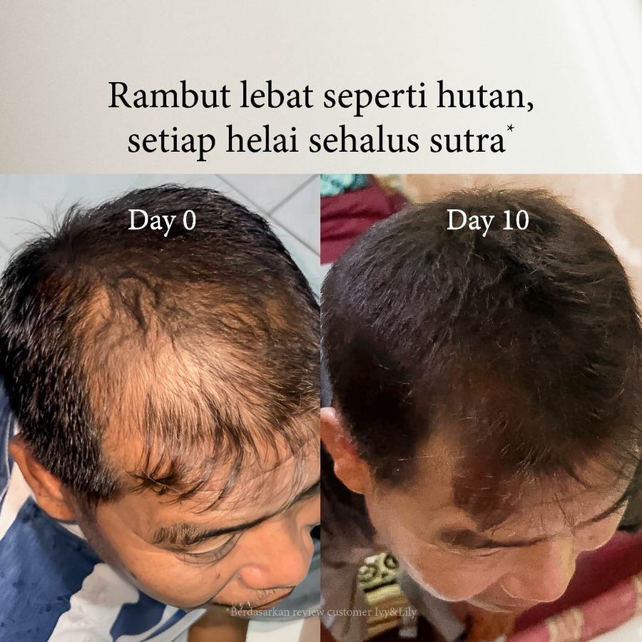  Ivy Beauty Collection Ivy & Lily Flower Alley Hair Fall Treatment Shampoo