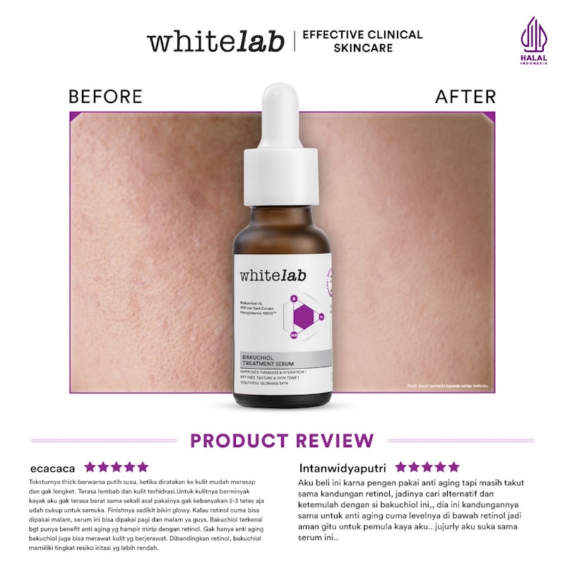 Bakuchiol Treatment Serum 5