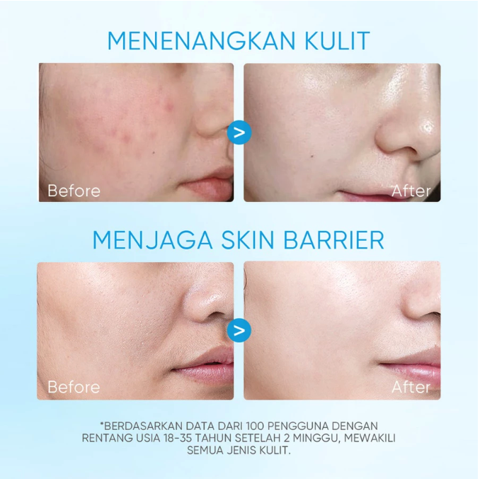 SKINTIFIC Cosmetics SKINTIFIC 5X Ceramide Soothing Toner