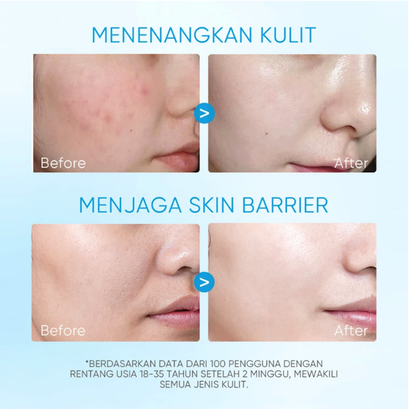 5X Ceramide Soothing Toner 4