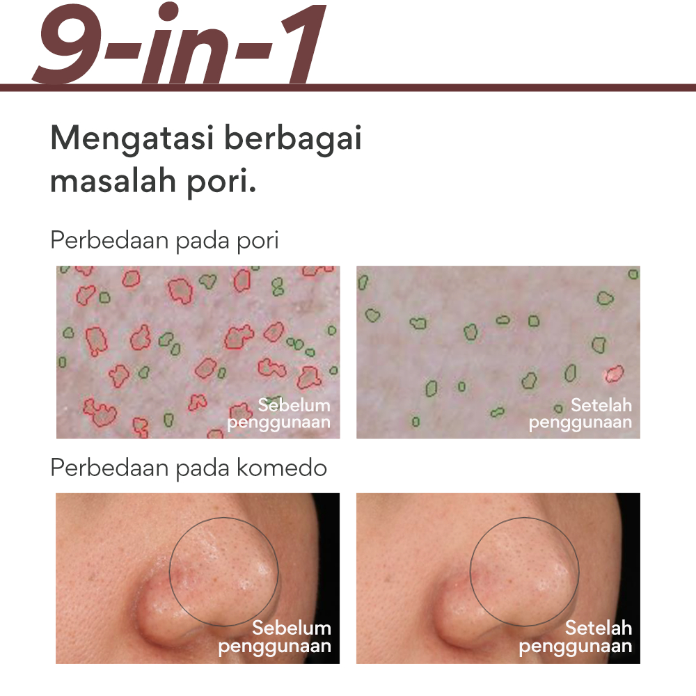 Innisfree Super Volcanic Pore Clay Mask 2X