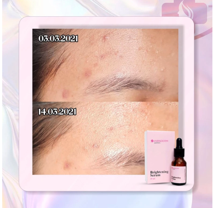 Airin Beauty Care Airnderm Aesthetic Brightening Serum 