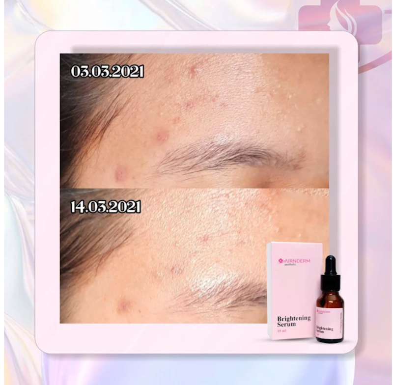 Airnderm Aesthetic Brightening Serum 4
