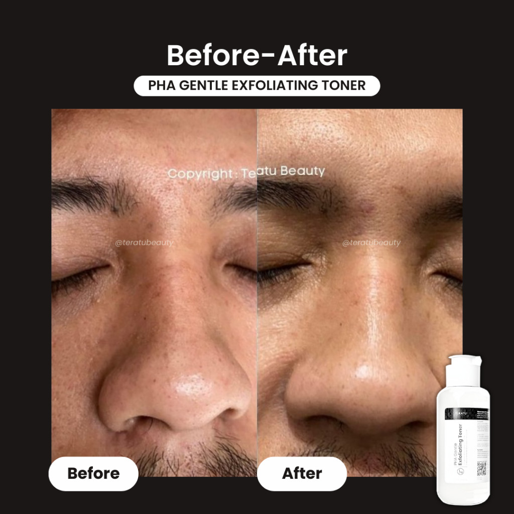 Fandi Universal Kosmekreasi Tératu Beauty Teratu Beauty PHA Gentle Exfoliating Toner