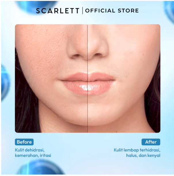 Opto Lingkar Sejahtera Scarlett Whitening Blue Hydra Intensive Calming Solution Serum