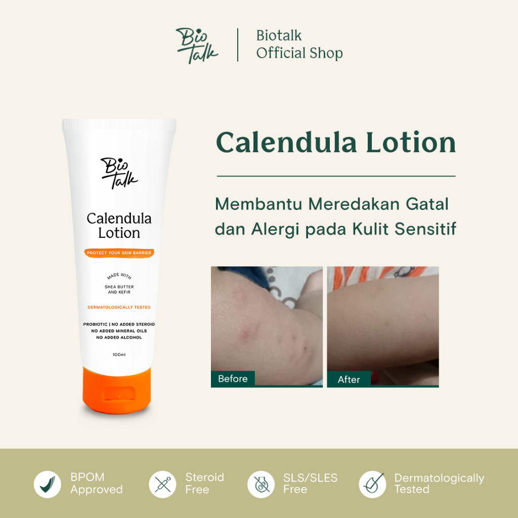 Bionatura Berkat Abadi BioTalk Calendula Lotion For Eczema and Dry Skin