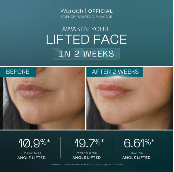 Paragon Technology and Innovation Wardah Exosome EGF-PDRN Lift Regenerating Serum