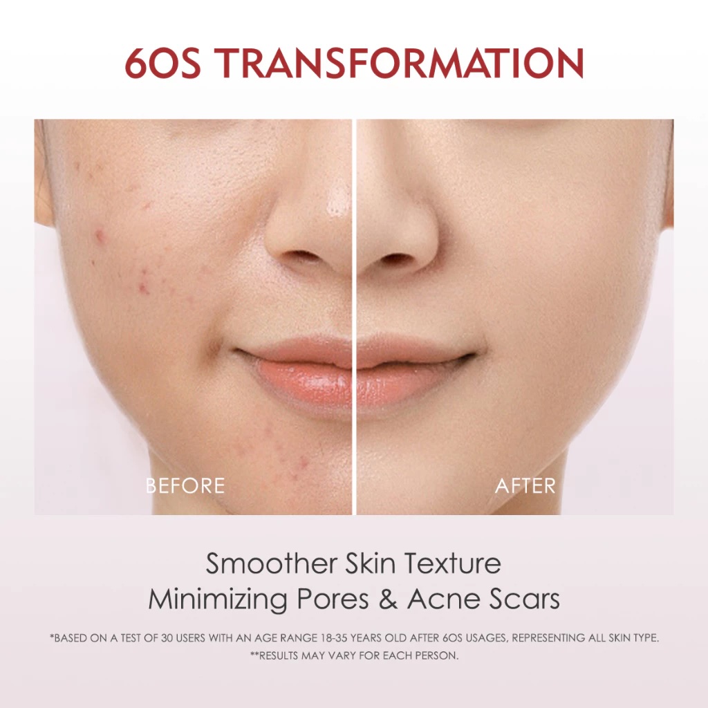 ELF Lab® ELFORMULA Intensive Peeling Solution