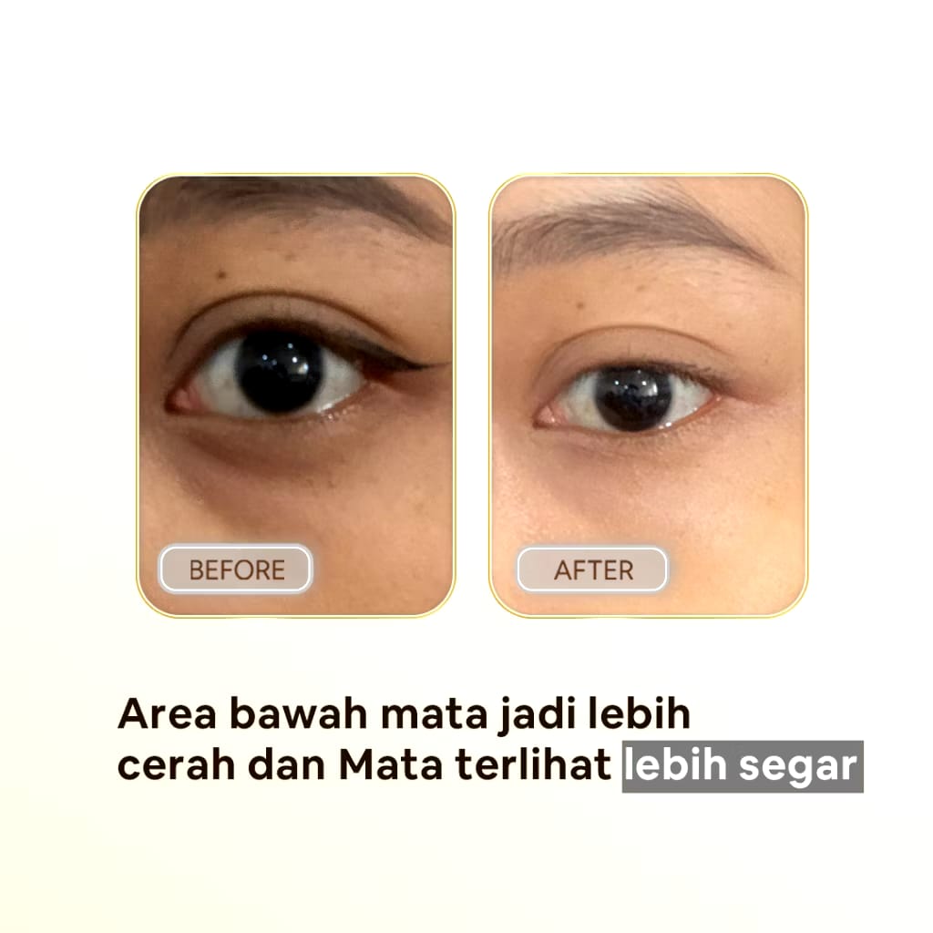 Ella Karunia Estetika Ella Skincare Whitening Active Eye & Lip Cream 