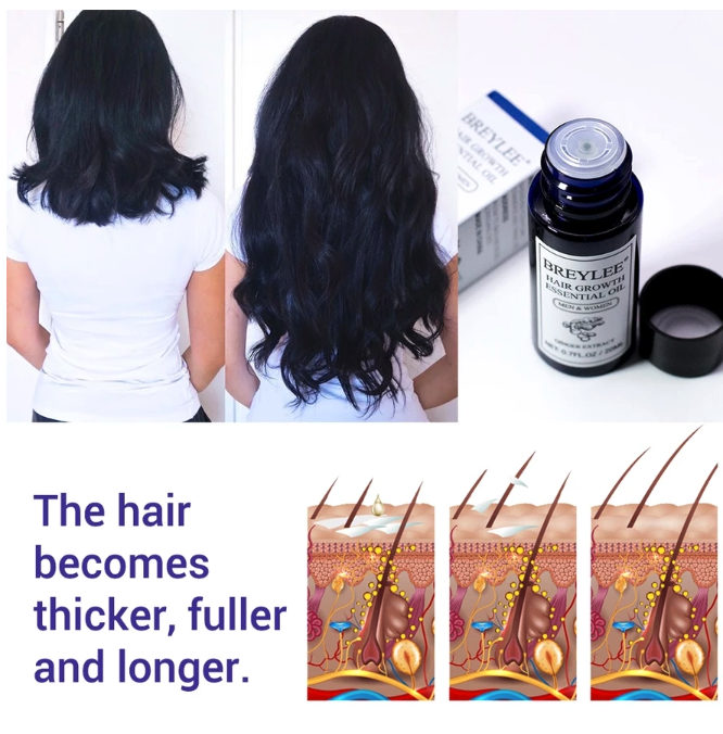 Guangzhou Shifei Bio-Tech Breylee Hair Growth Essential Oil