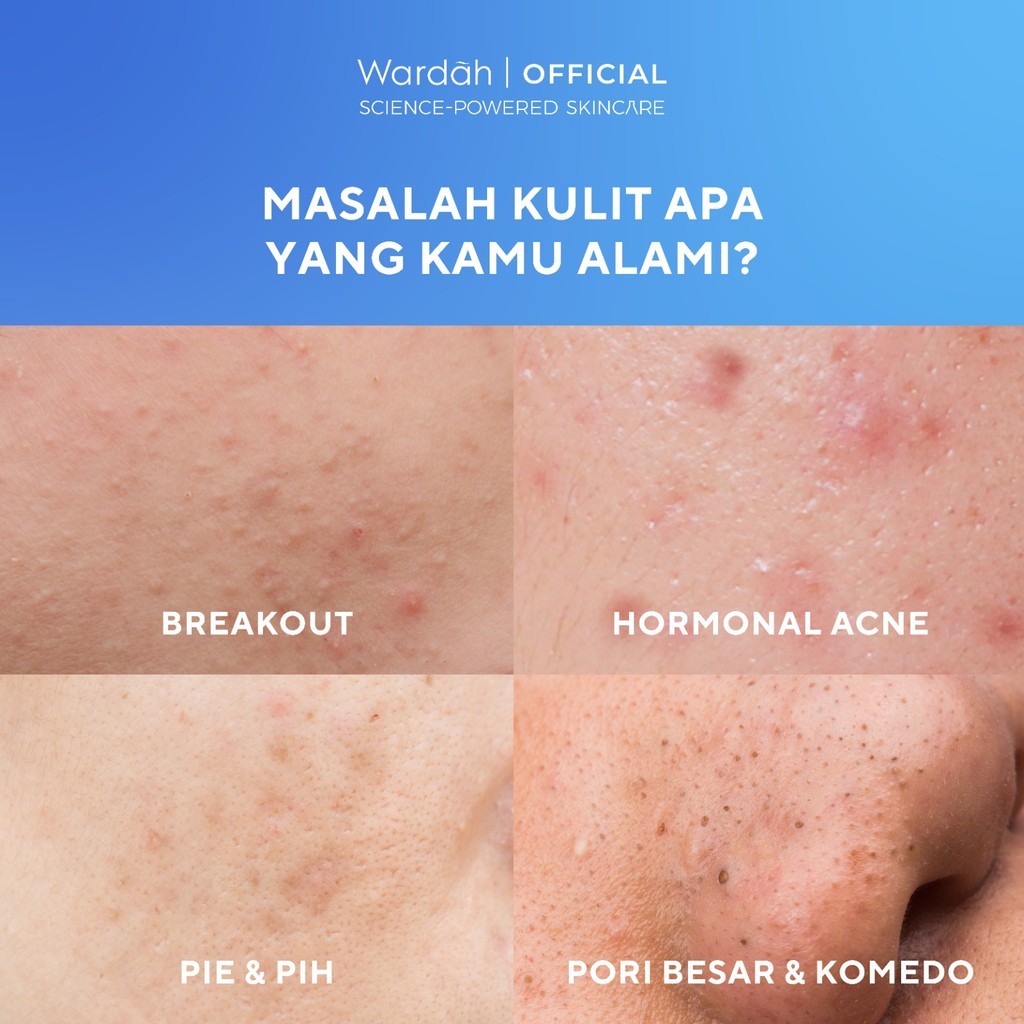 Paragon Technology and Innovation Wardah UV Shield Acne Calming Sunscreen Moisturizer