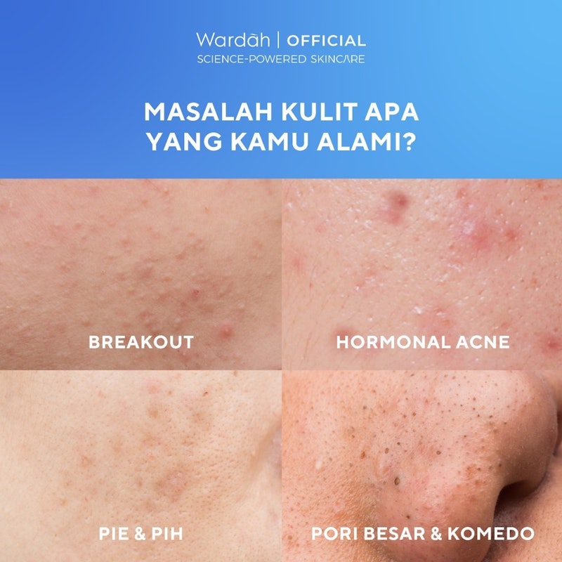 UV Shield Acne Calming Sunscreen Moisturizer 2