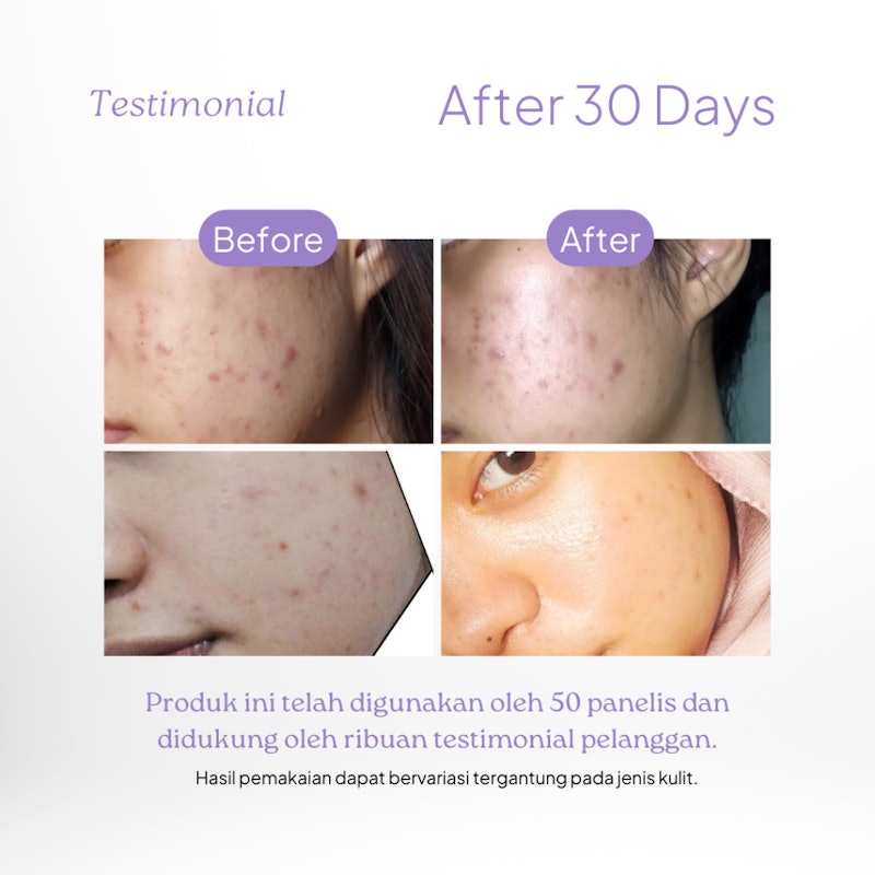 dörskin BeterSkin Spot Savior Serum 3