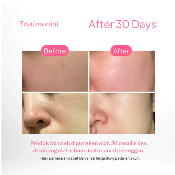 Dorskin Kreasi Indonesia dörskin Pink Bliss Moisturizer