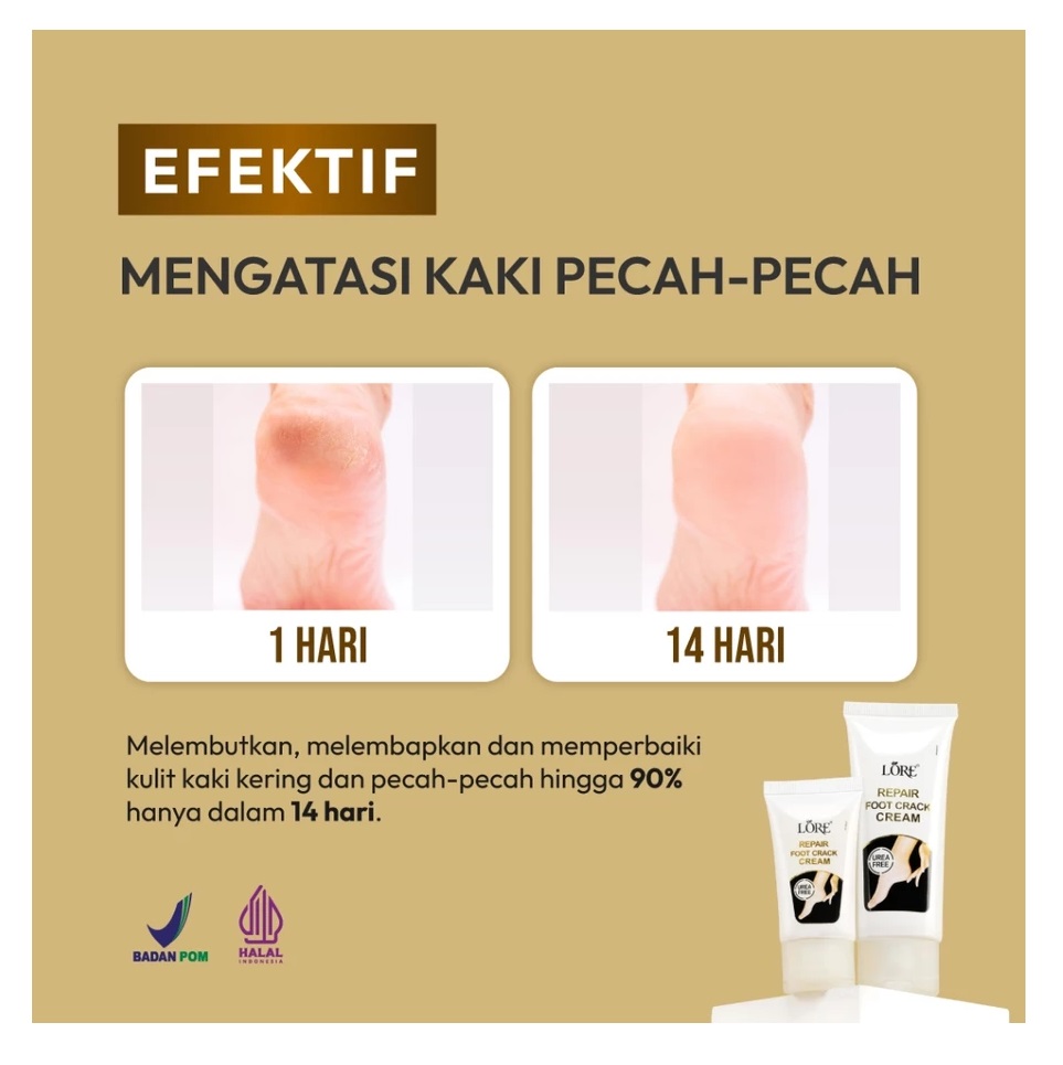 Lore Luxurious LORE® Repair Foot Crack Cream