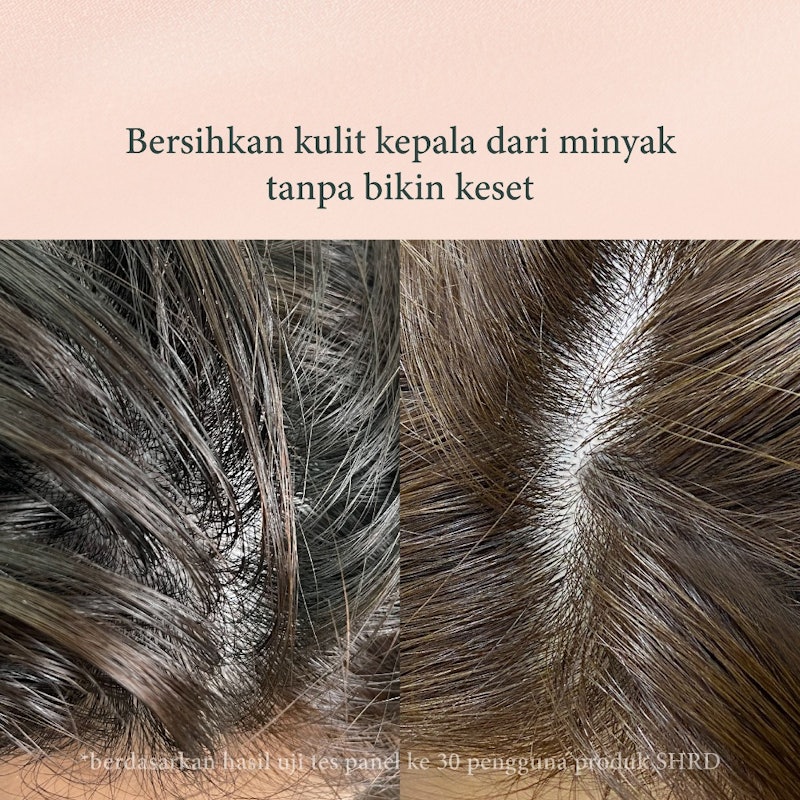 SH-RD Red Ginseng Hair Activating Shampoo 3