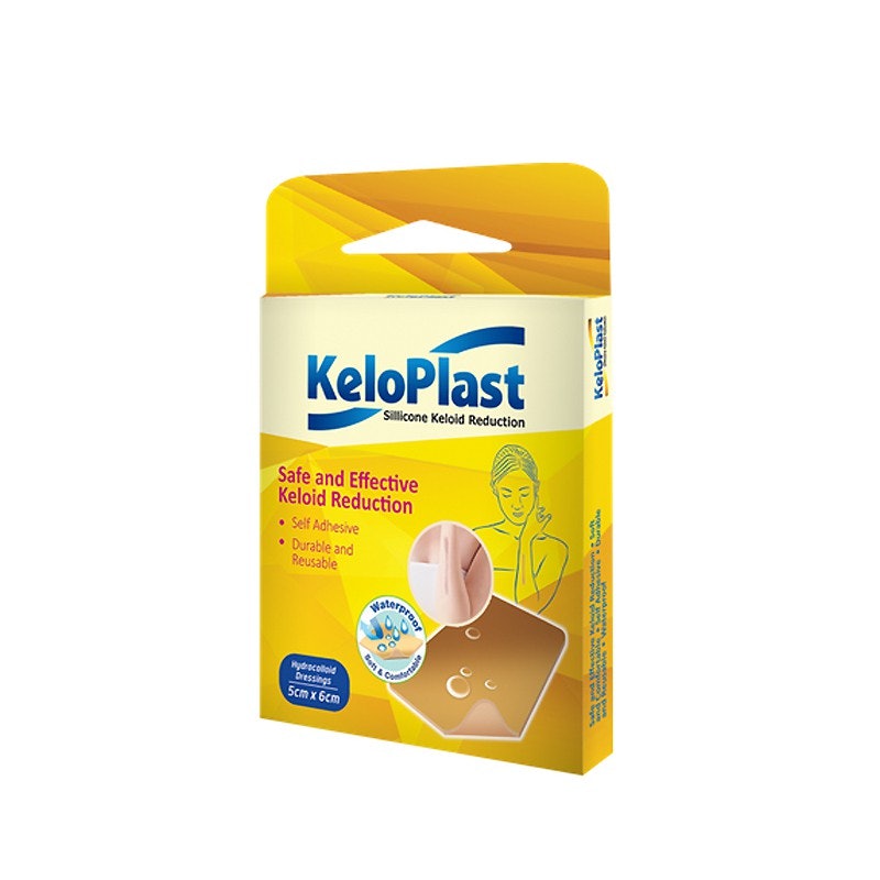 Keloplast Silicone Keloid Reduction 2