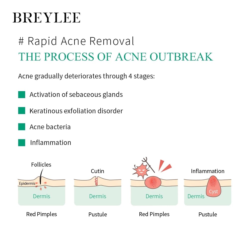 Breylee Indonesia BREYLEE Acne Pimple Patch Night