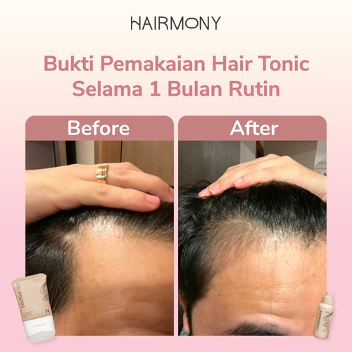 Megah Cantika Indonesia Hairmony Voluminous & Grow Scalp Treatment Hair Tonic Serum