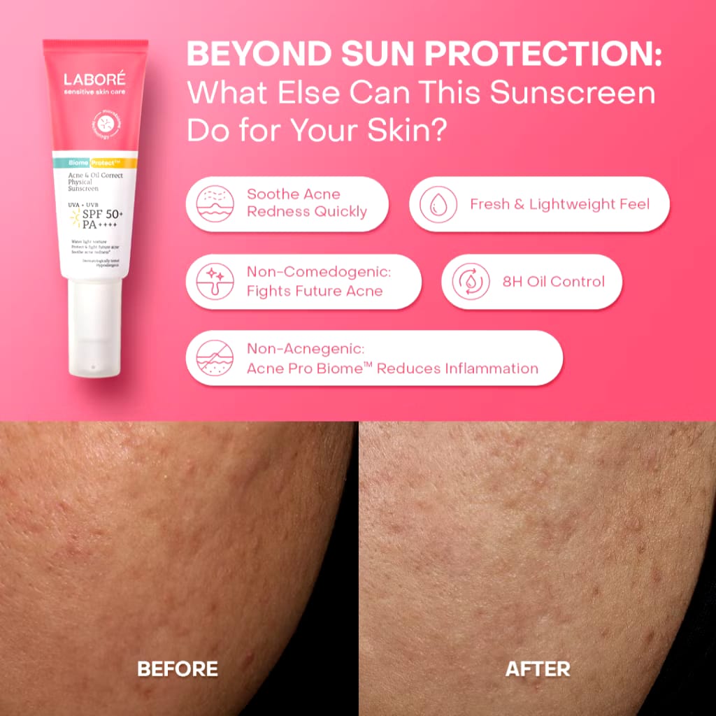 Paragon Technology and Innovation LABORÉ Acne & Oil Correct Physical Sunscreen