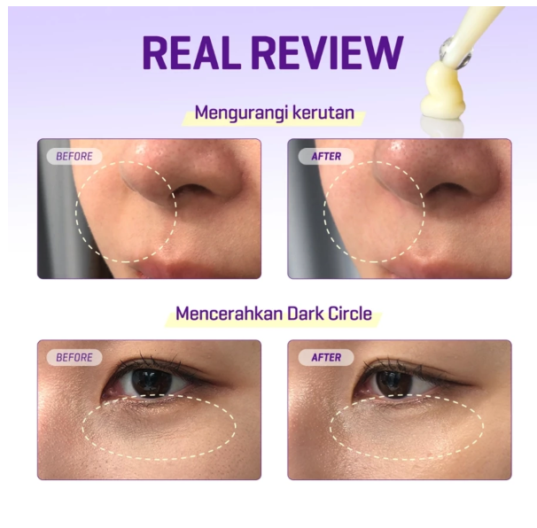 Retinol Intense Advanced Triple Action Eye Cream 4