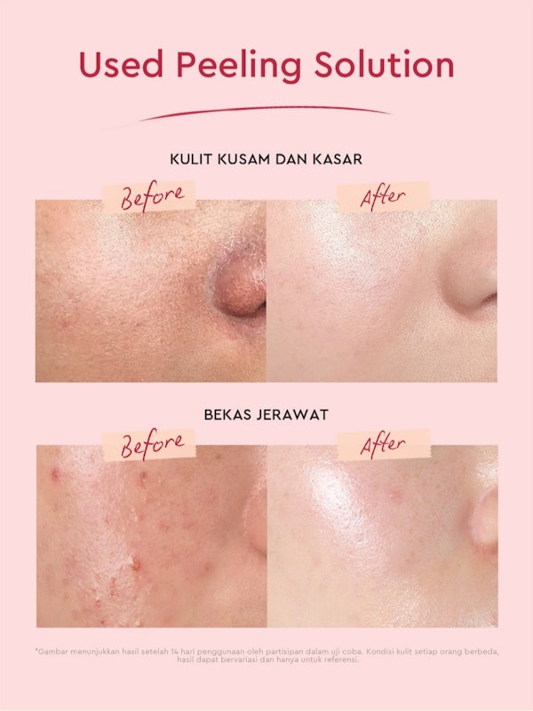 Glad2Glow Peeling Solution 2