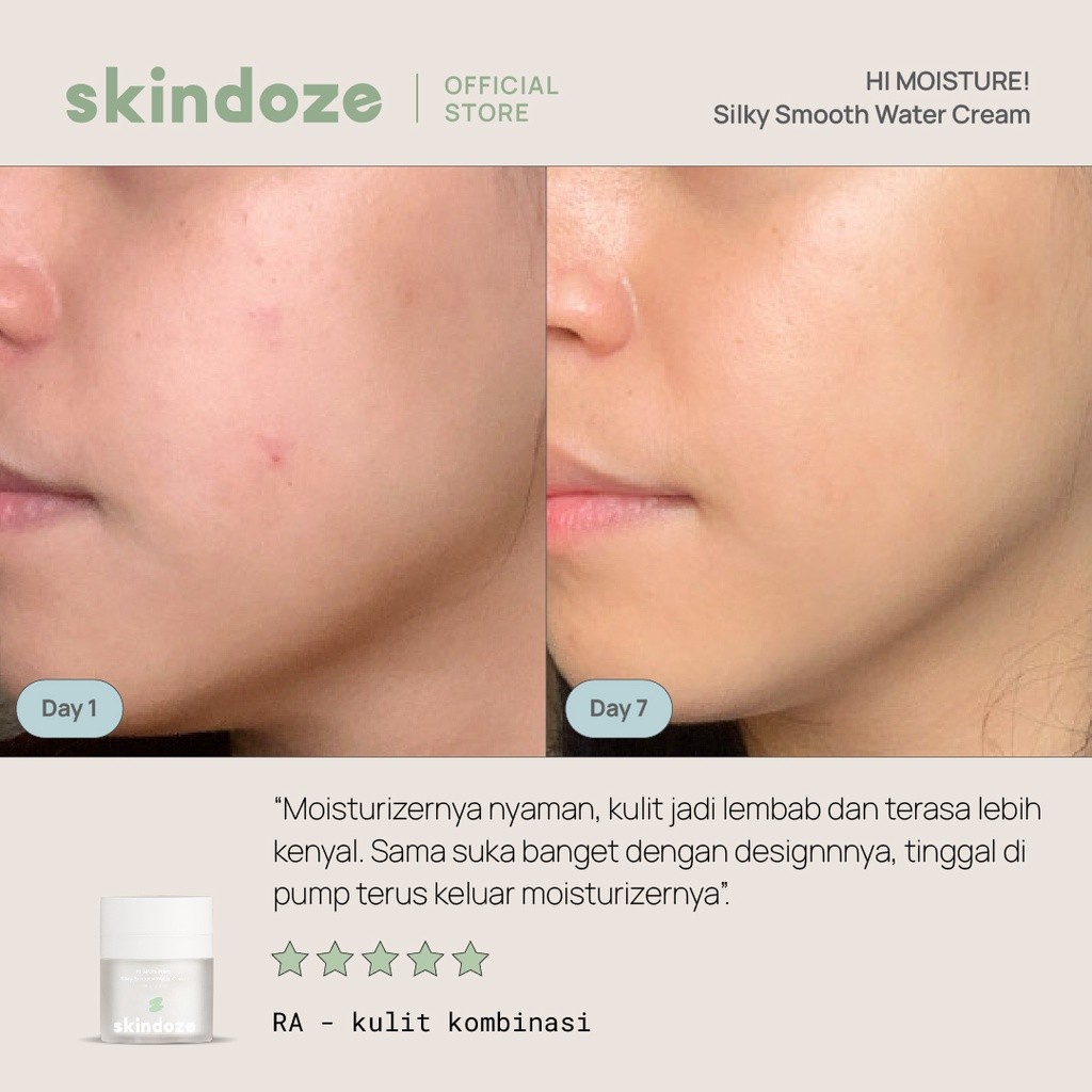 Hidup Melawan Waktu Skindoze HI MOISTURE! Silky Smooth Water Cream