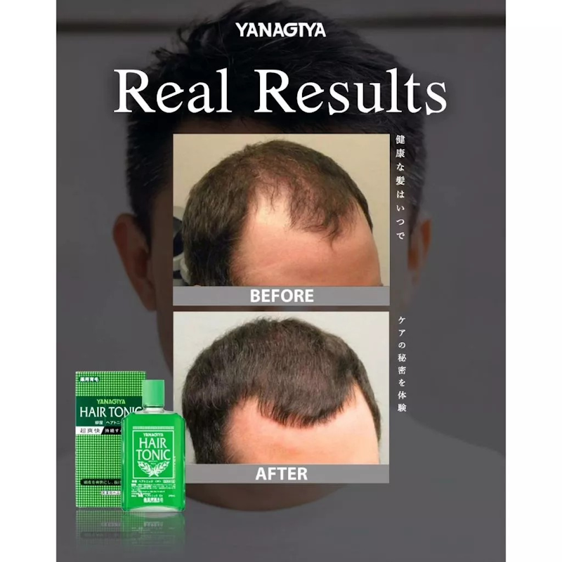 YANAGIYA Hair Tonic Citrus 3