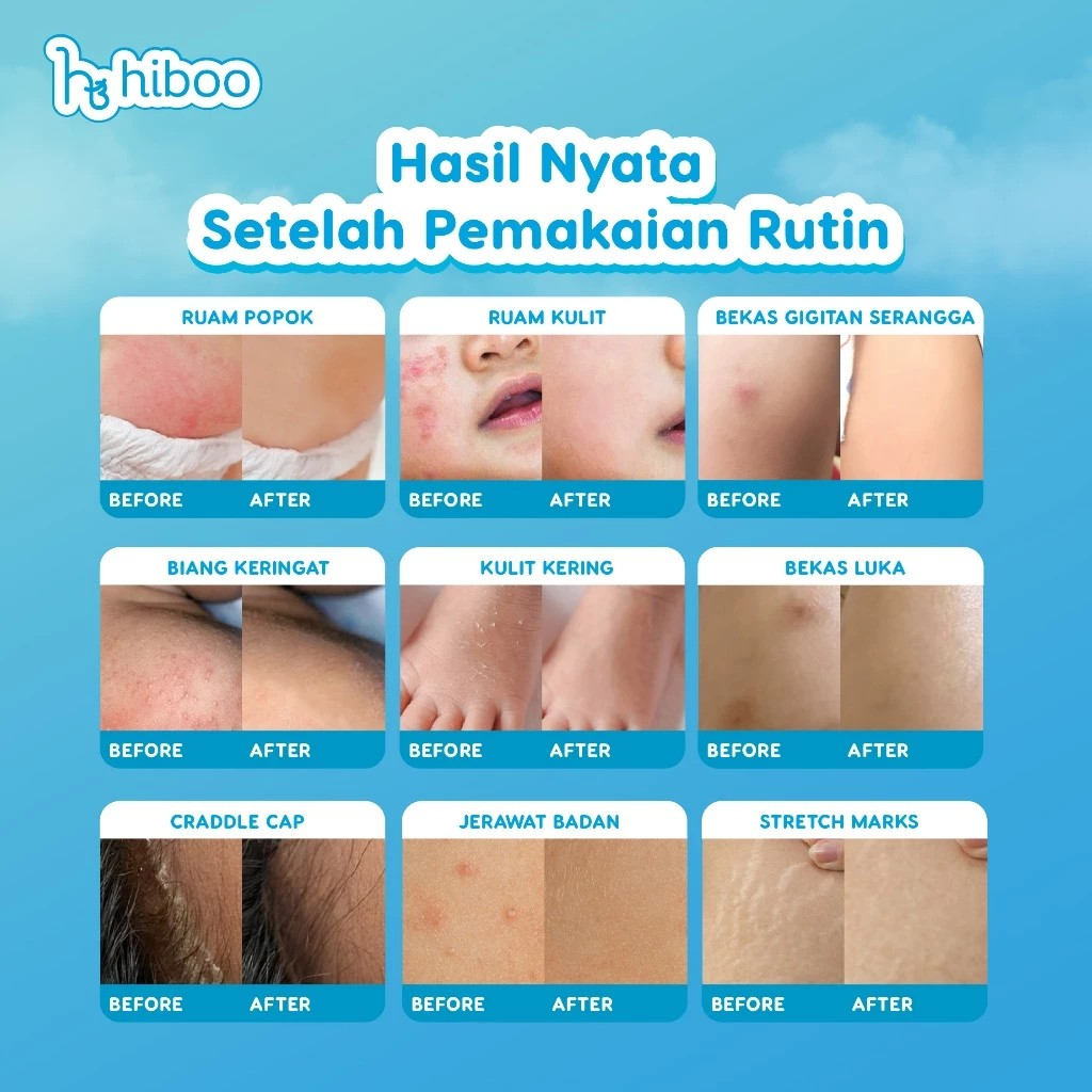 Hiboo Indonesia Hiboo All Purpose Baby Balm