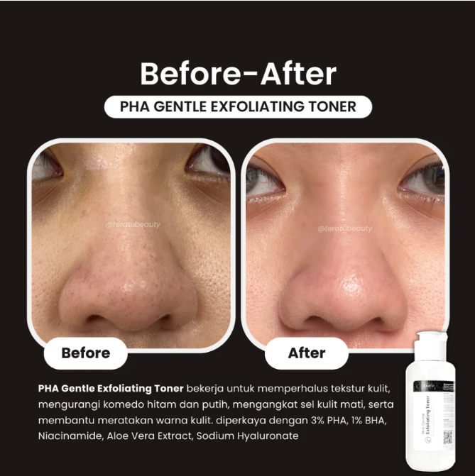 Fandi Universal Kosmekreasi Tératu Beauty PHA Gentle Exfoliating Toner