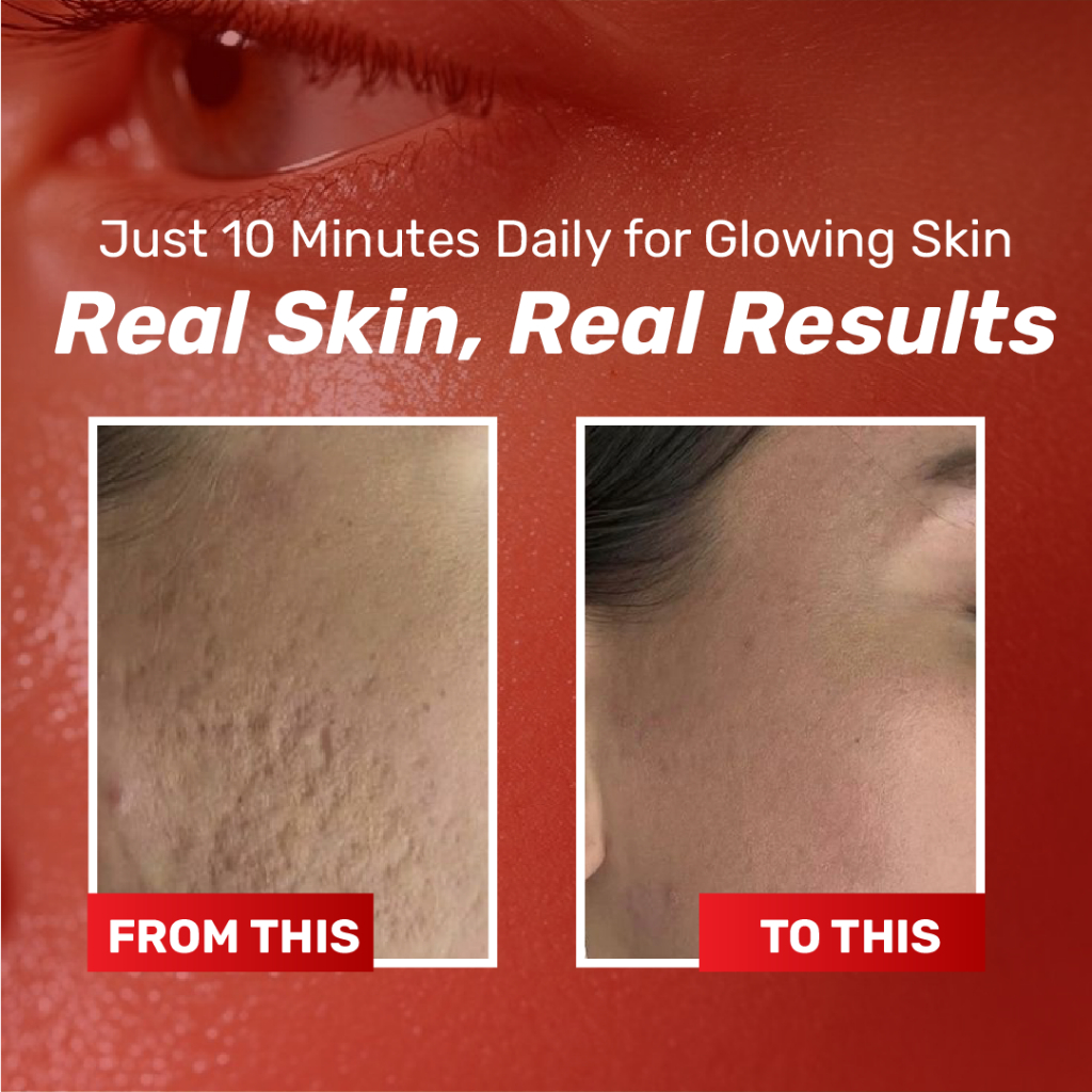 Chalonese Brightening Cream