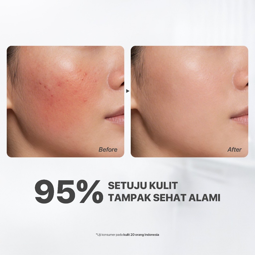 Penta Natural Kosmetindo N'PURE Noni Probiotics Comfort Me Hypoallergenic Moisturizer