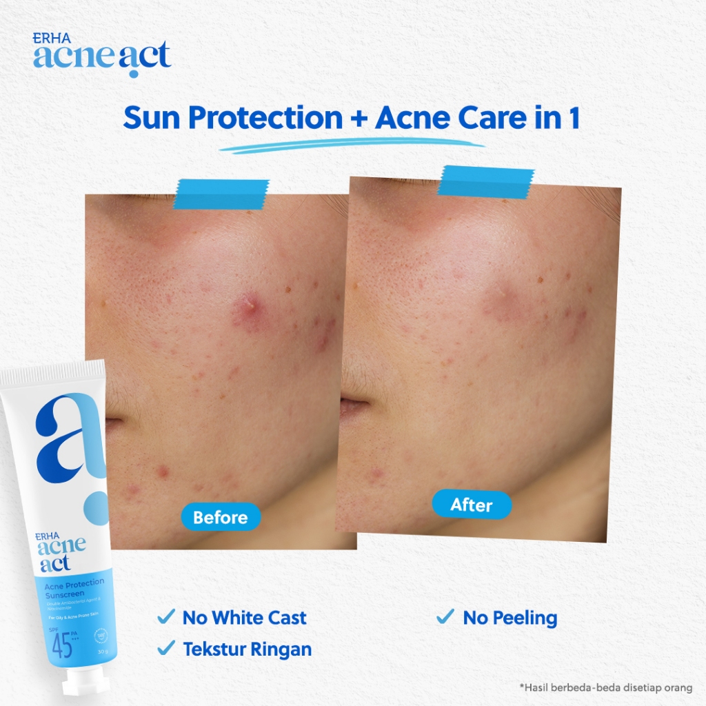 ERHA Clinic Indonesia AcneAct Acne Protection Sunscreen SPF 45 PA+++