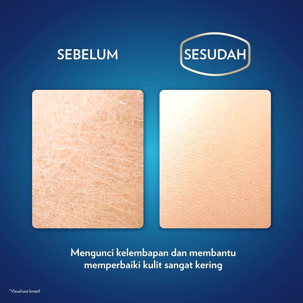 Unilever Indonesia Vaseline® Original 100% Pure Repairing Jelly