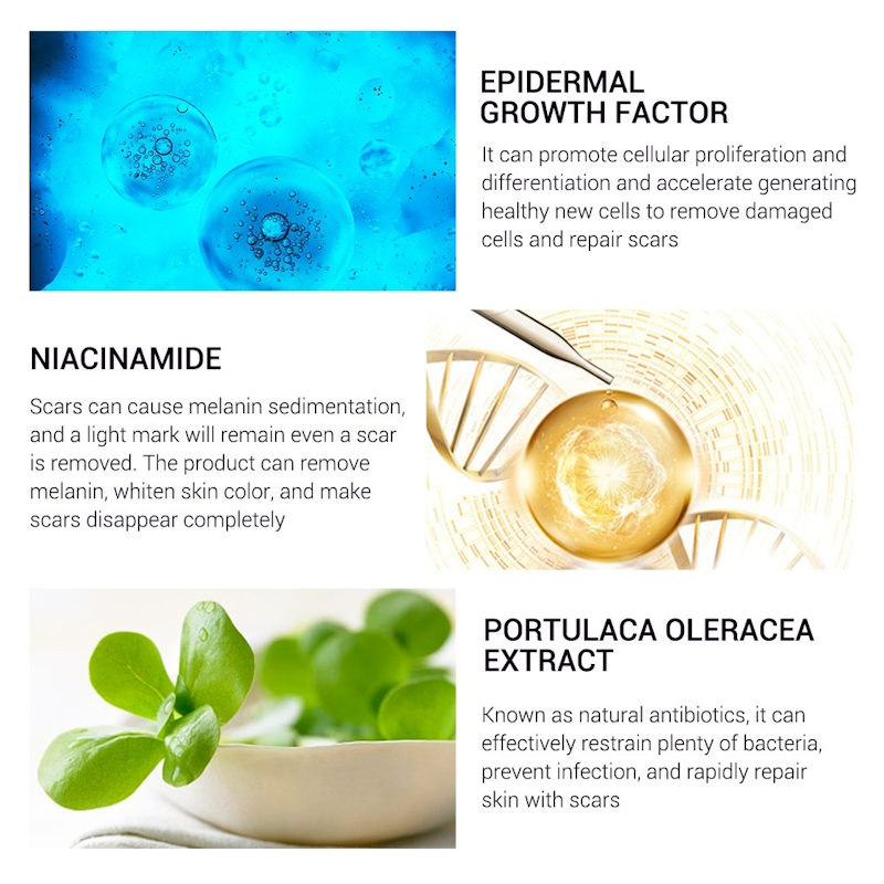 BREYLEE Acne Scar Removal 5