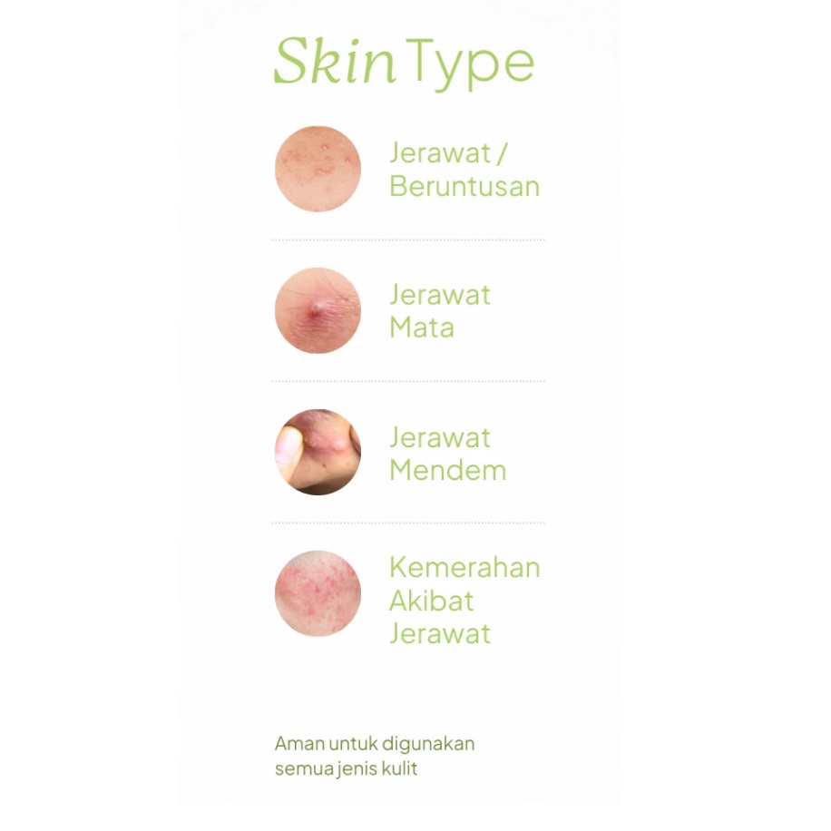 Dorskin Kreasi Indonesia Dörskin BeterSkin Acne Calming Potion