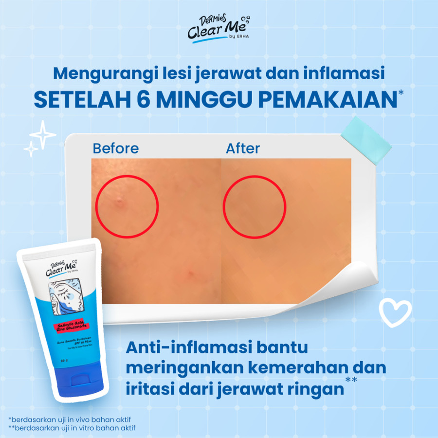 ERHA Clinic Indonesia Dermies Clear Me Acne Smooth Sunscreen SPF30 PA++