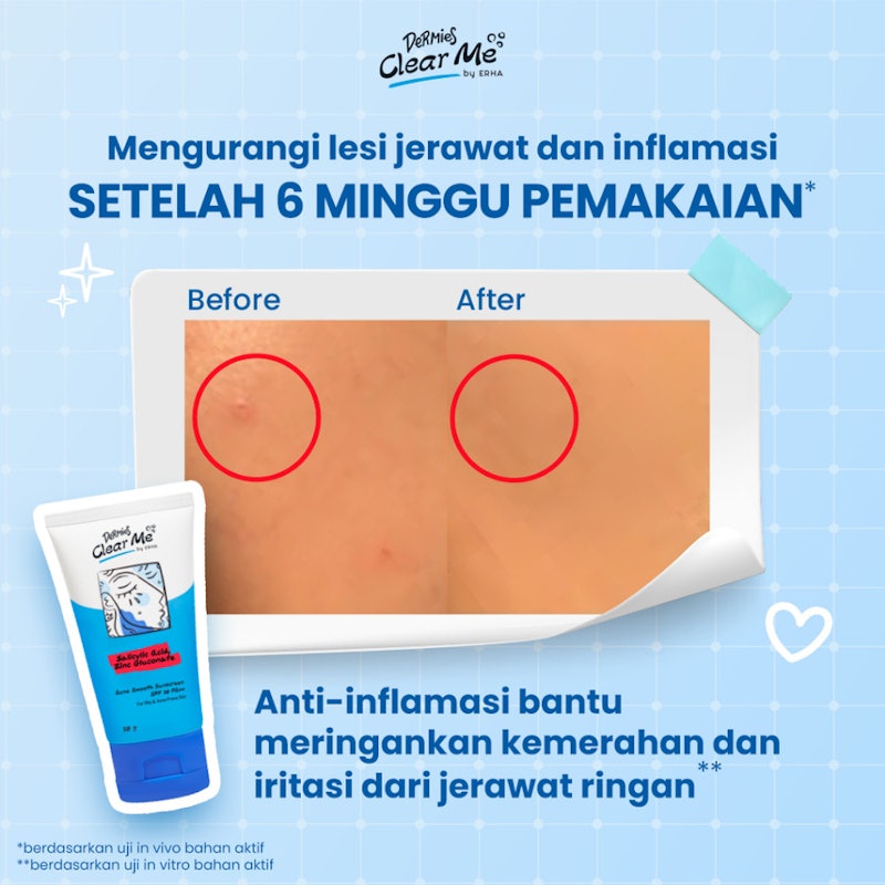 Clear Me Acne Smooth Sunscreen SPF30 PA++ 3