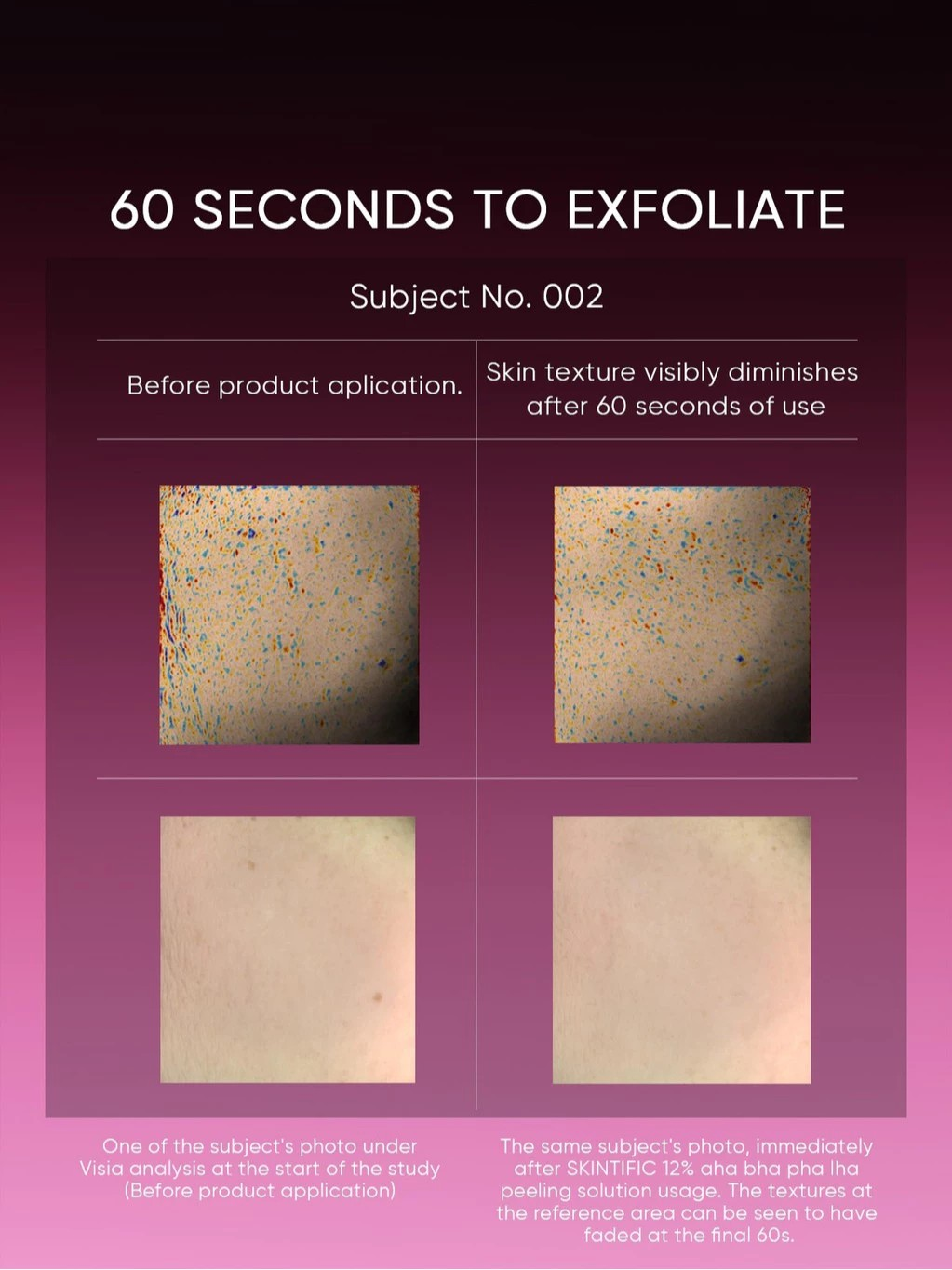 SKINTIFIC Cosmetics SKINTIFIC 12% AHA BHA PHA LHA Peeling Solution