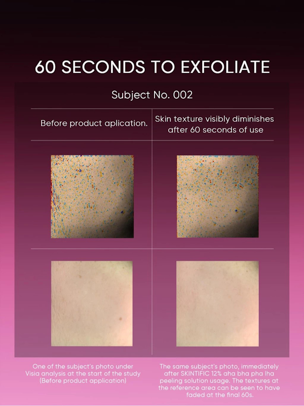 12% AHA BHA PHA LHA Peeling Solution 4