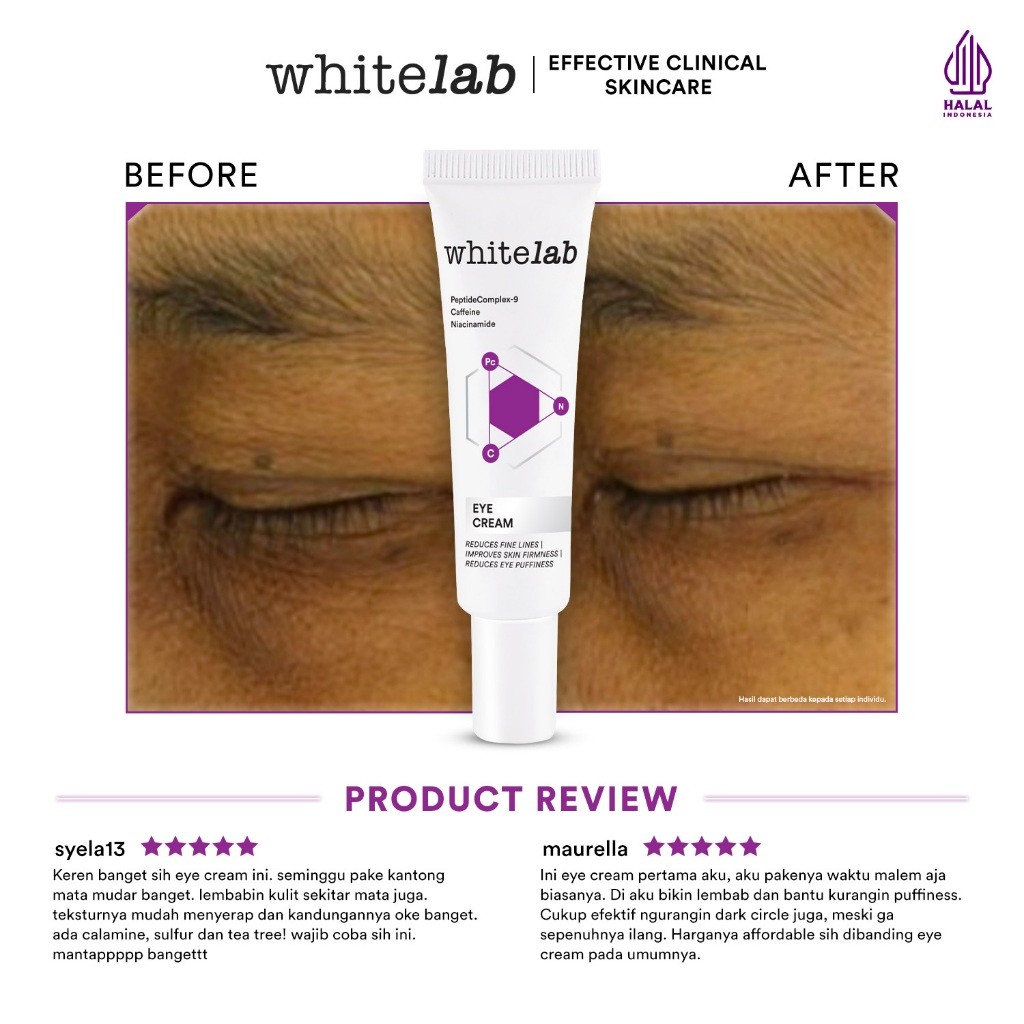 Whitelab Whitelab Eye Cream