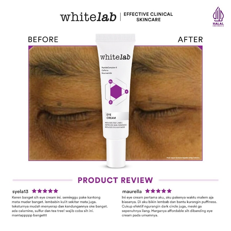 Whitelab Eye Cream 3