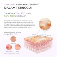 Triple Care Acne Calm Cleanser 2