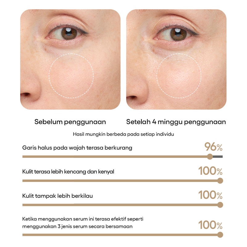 Perfect Renew 3X Signature Serum Advanced 5