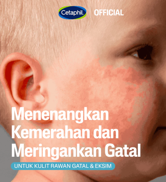 Cetaphil Pro AD Derma Skin Restoring Moisturizer