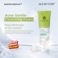 Acne Gentle Cleansing Foam 4