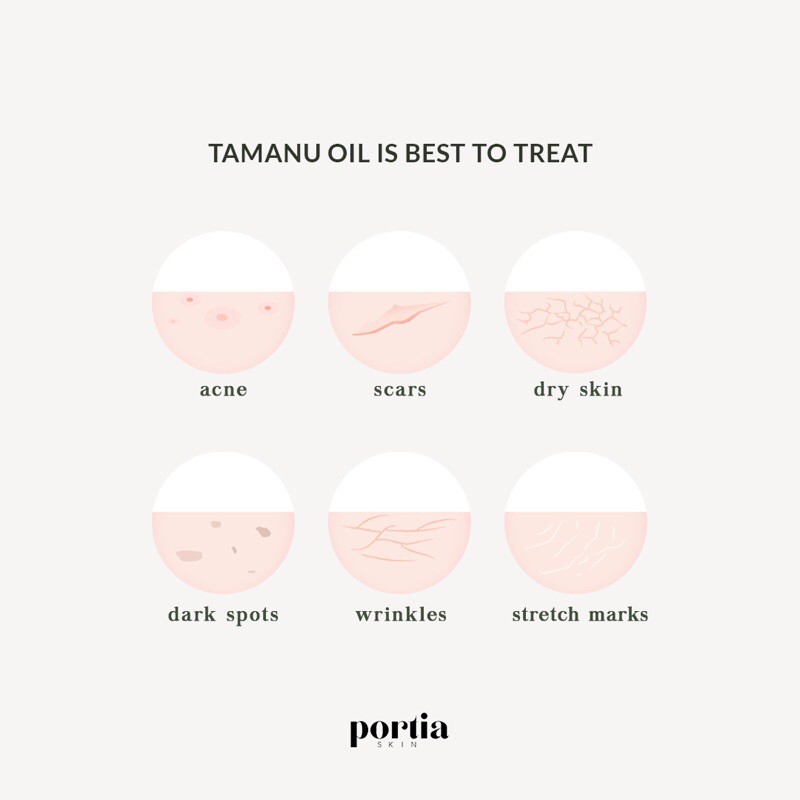 Laras Natura Portia Skin Tamanu Oil