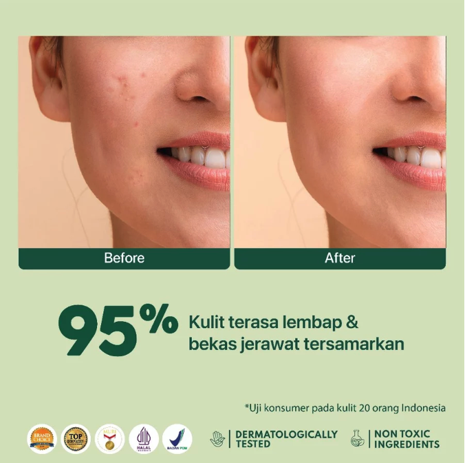 Penta Natural Kosmetindo N'PURE Centella Asiatica Acne Clear Barrier Moisturizer
