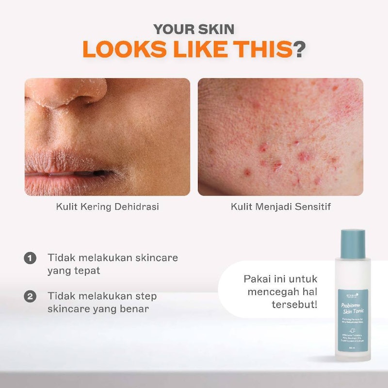 Probiome Skin Tonic 4