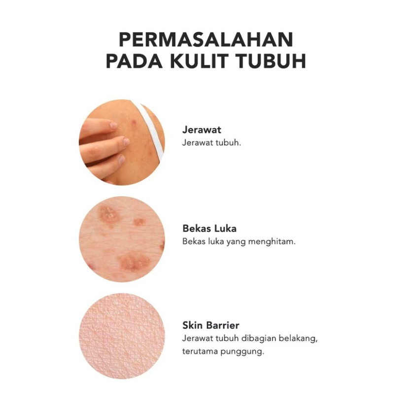  Grace and Glow English Pear and Freesia Anti Acne Hand and Body Lotion